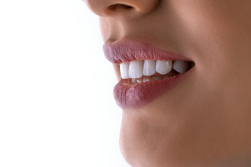 Sourire aux dents blanches et naturelles