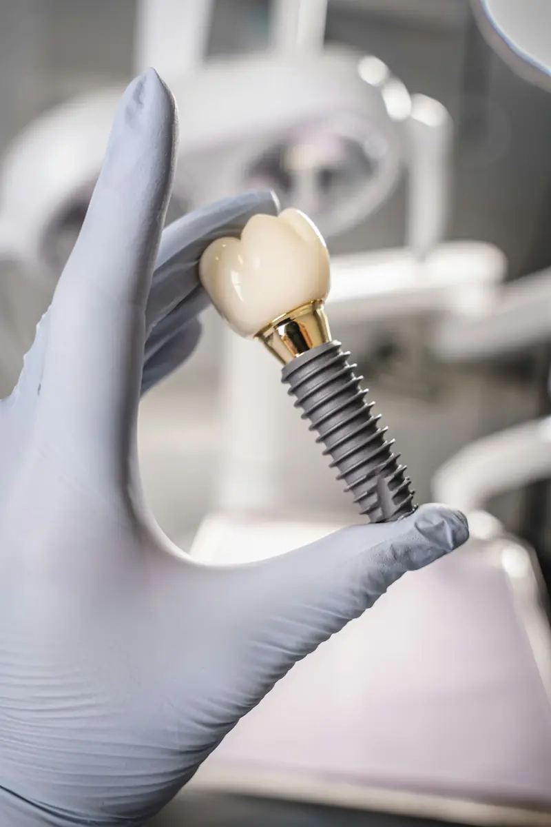 Implant dentaire et sa couronne céramique